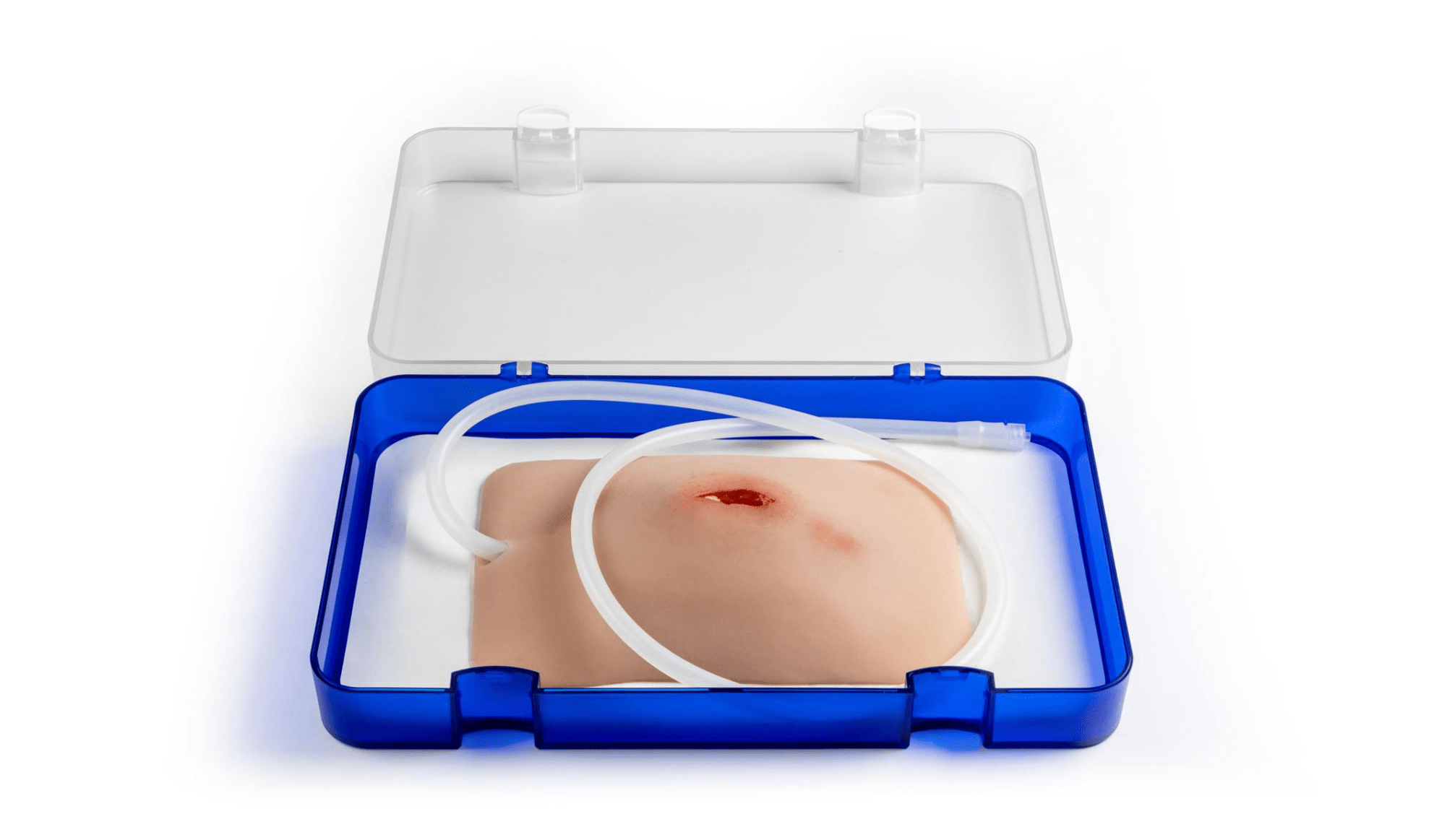 Wundmoulage Stich Leiste, Wound Packing - Erler - Zimmer